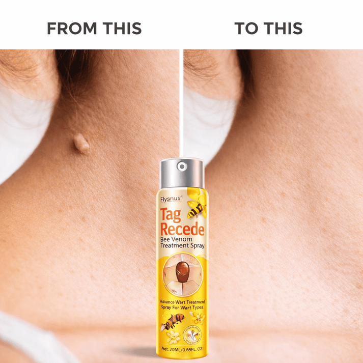 MD Advance Wart Remover Spray – Fast & Easy At-Home |Bee Venom Skin Tag Remover Spray