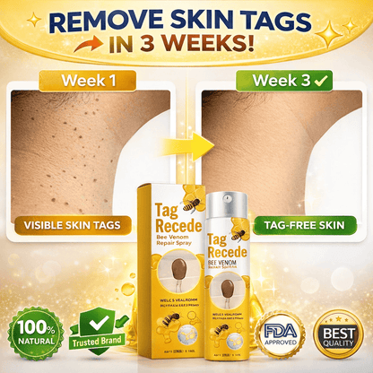 MD Advance Wart Remover Spray – Fast & Easy At-Home |Bee Venom Skin Tag Remover Spray